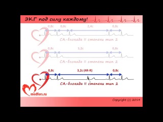 school of ecg - 6