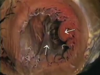 human heart anatomy
