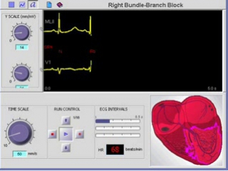 correspondence of the ecg complex to the contraction of the heart. blockade of the upper branches of the right leg of the bundle of his.